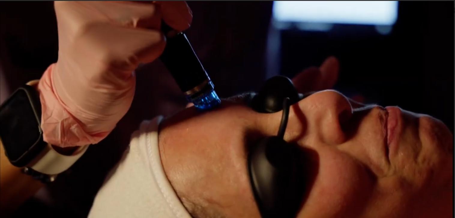A woman with protective eyewear receiving a HydraFacial treatment in Boise, Idaho